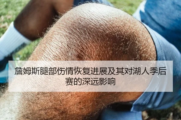 詹姆斯腿部伤情恢复进展及其对湖人季后赛的深远影响
